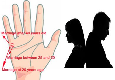 Second Marriage Prediction by Palmistry